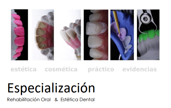Especialización Rehabilitación Oral y Estética Dental